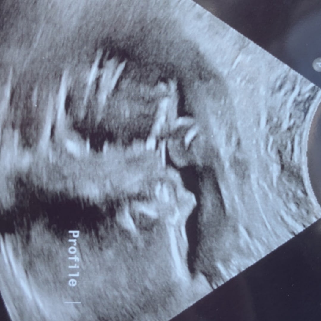 Photo shared by Keaton for their Babylist baby registry.