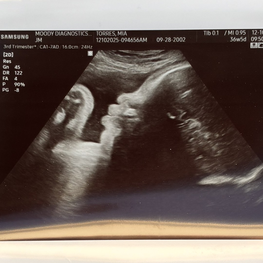 Photo shared by Mia for their Babylist baby registry.