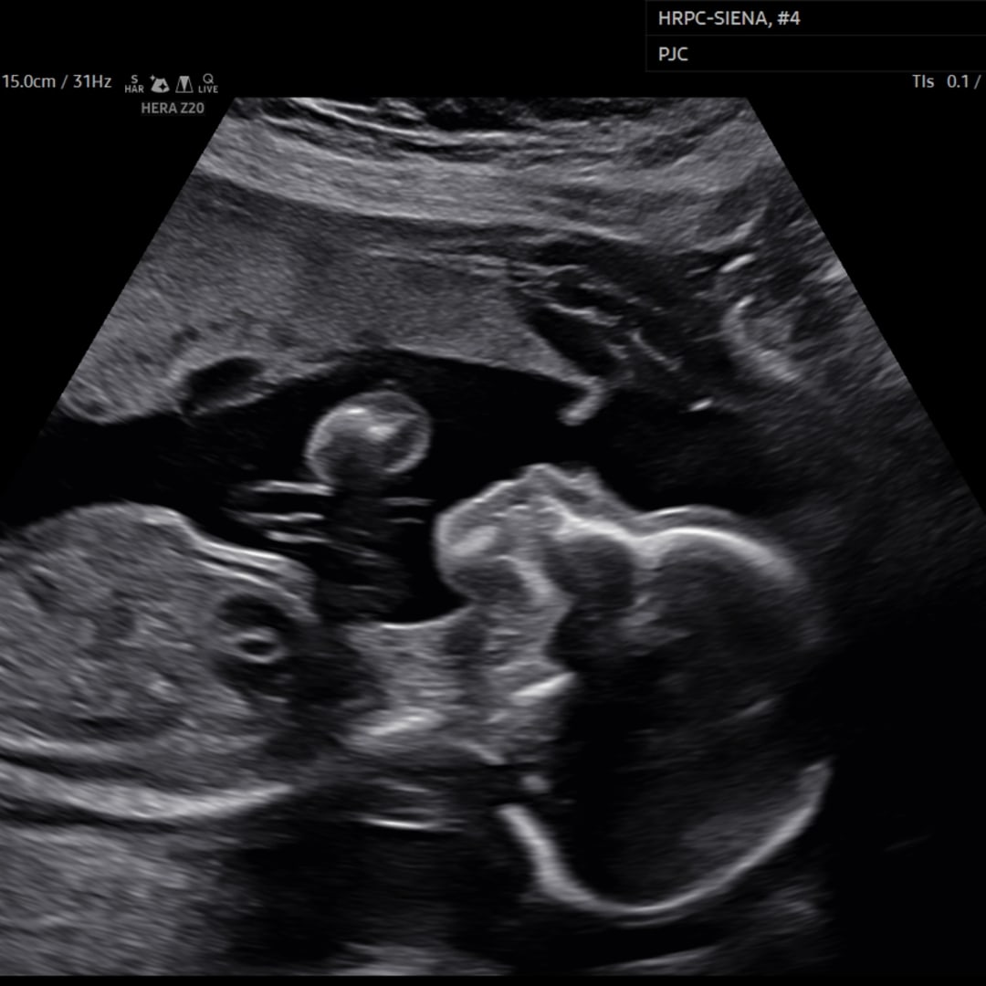 Photo shared by Jaquelyn for their Babylist baby registry.