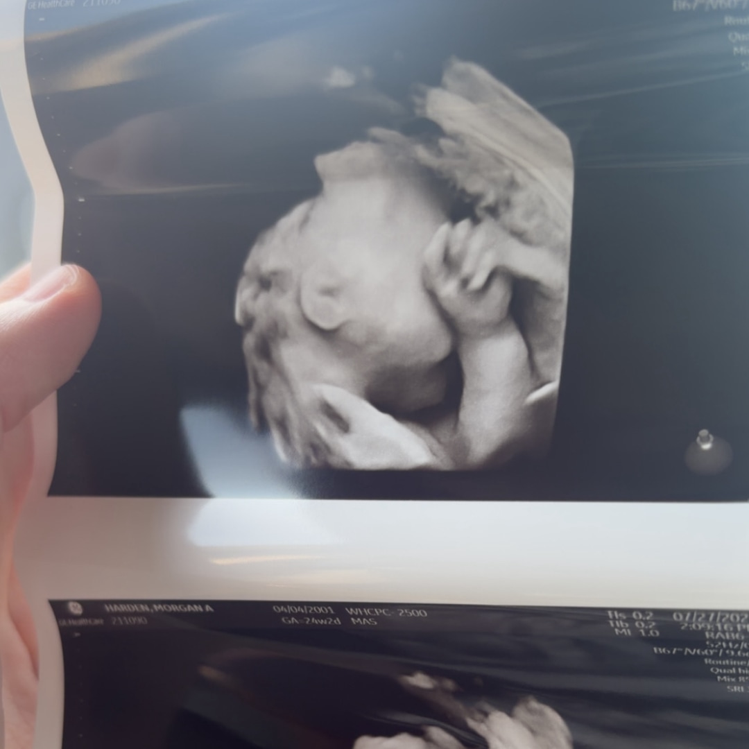 Photo shared by Morgan for their Babylist baby registry.