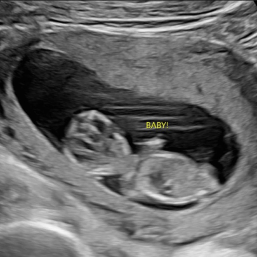 Photo shared by Francesca for their Babylist baby registry.