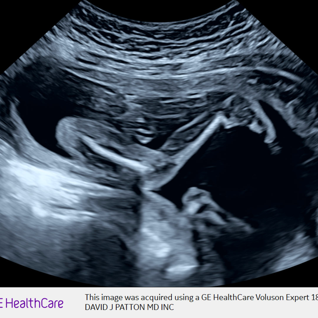 Photo shared by Christopher for their Babylist baby registry.