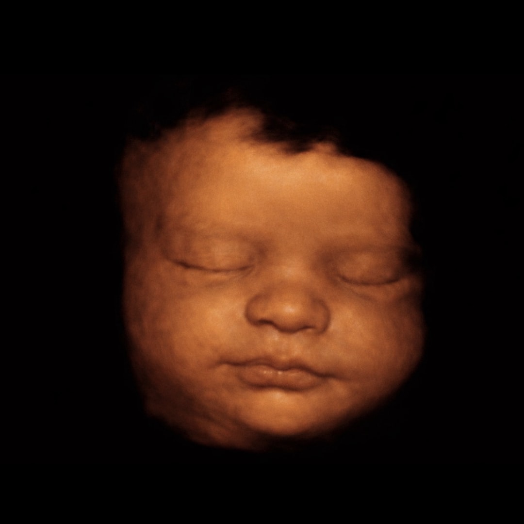 Photo shared by Kylie for their Babylist baby registry.