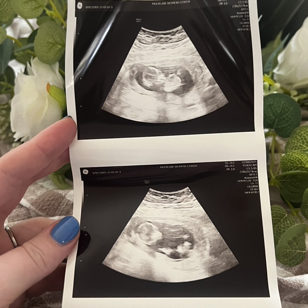 Photo shared by Simone for their Babylist baby registry.