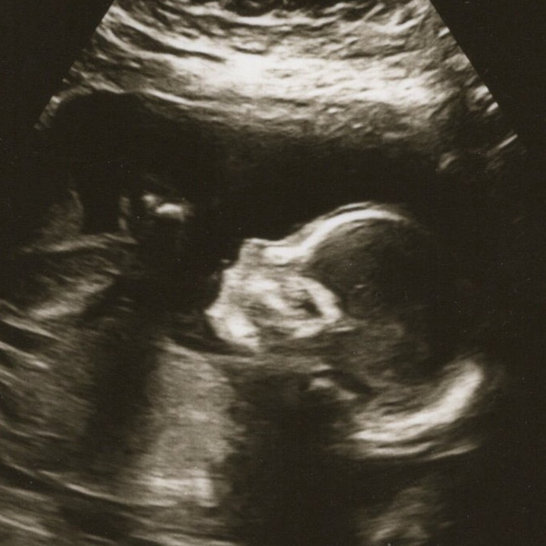 Photo shared by Hannah for their Babylist baby registry.