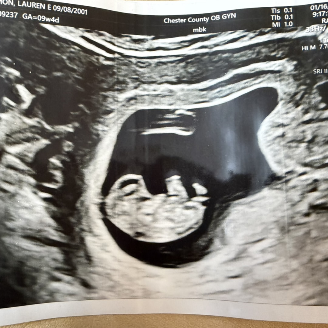 Photo shared by Lauren for their Babylist baby registry.
