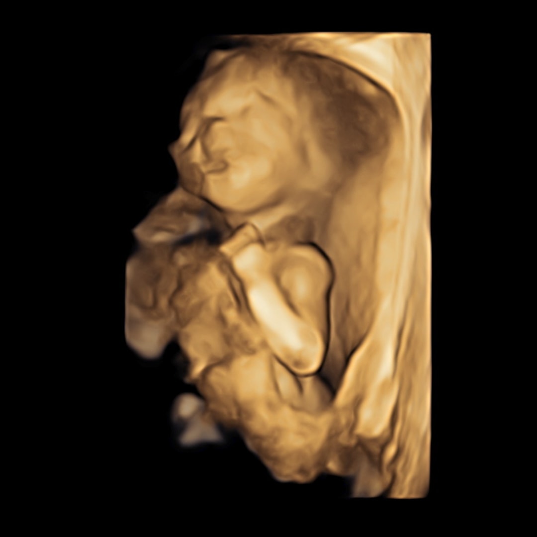 Photo shared by Emily for their Babylist baby registry.