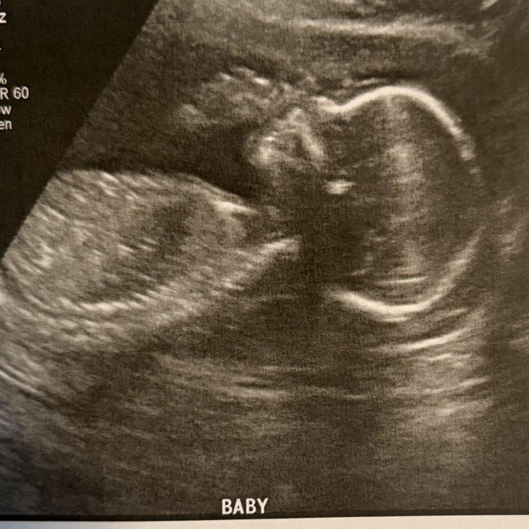 Photo shared by Mireya for their Babylist baby registry.