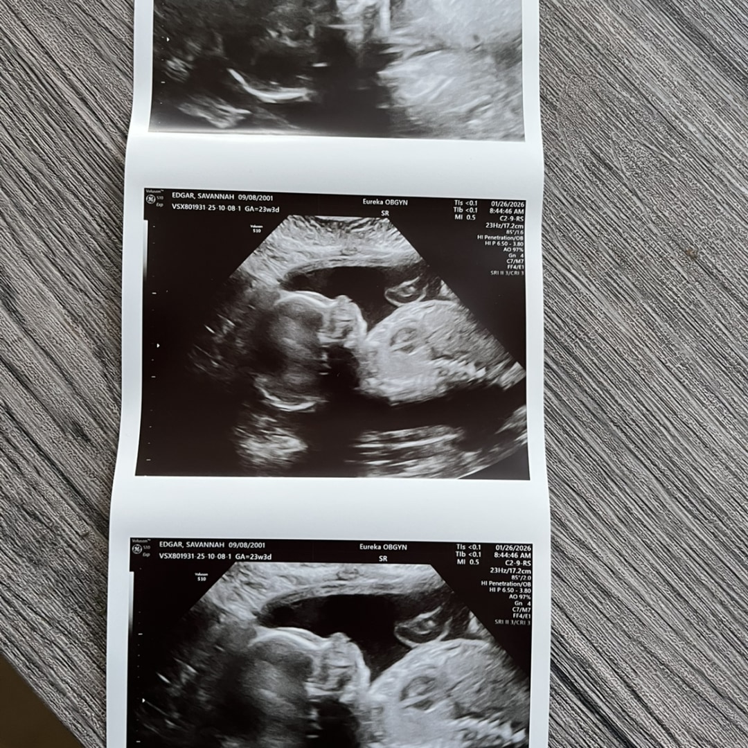 Photo shared by Savannah for their Babylist baby registry.