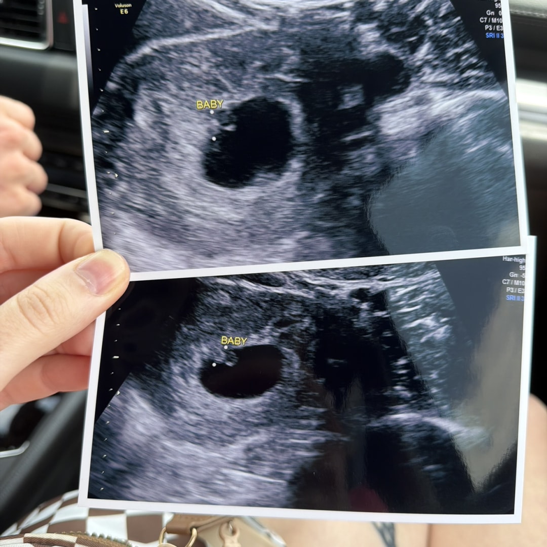 Photo shared by Hayle for their Babylist baby registry.
