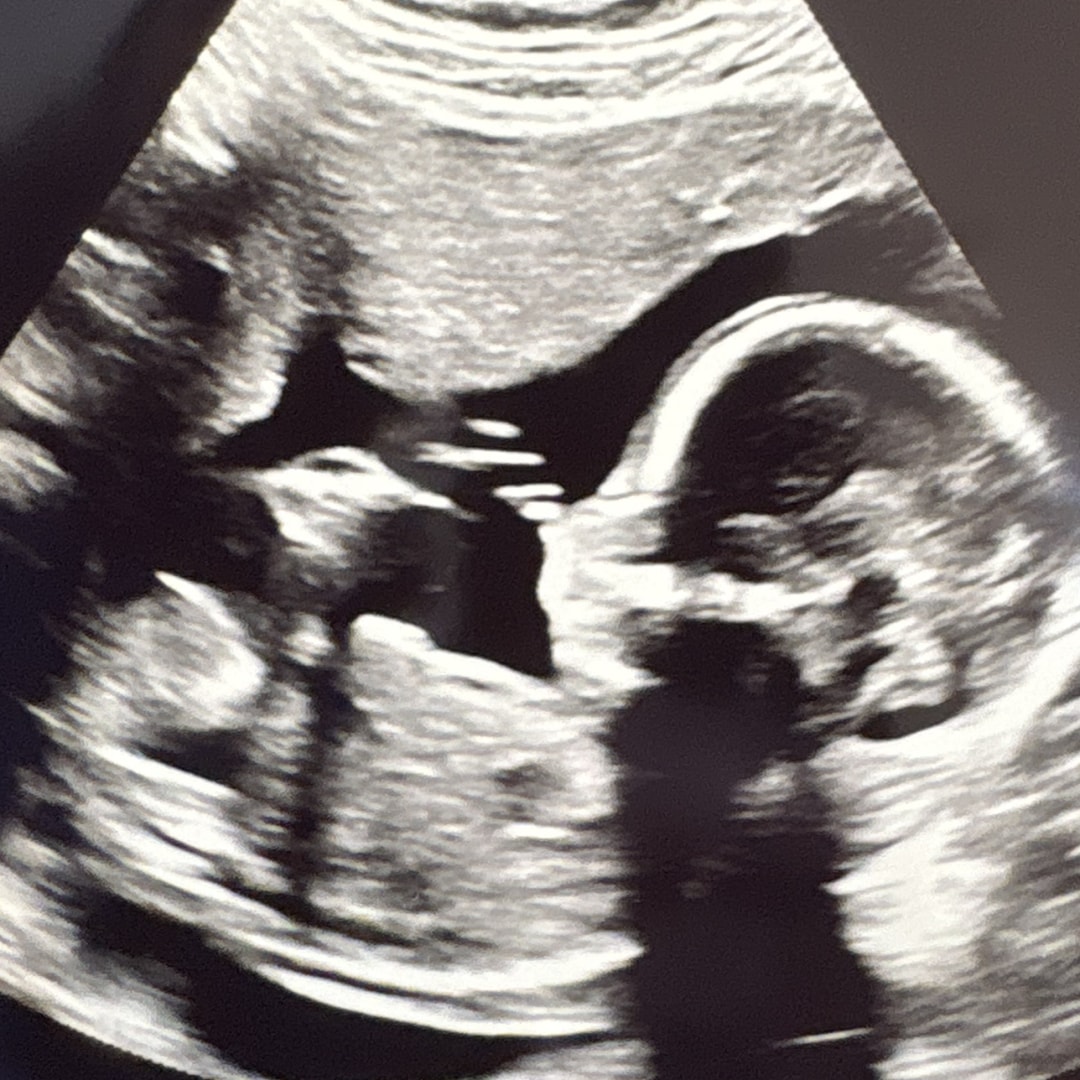 Photo shared by Jewly for their Babylist baby registry.