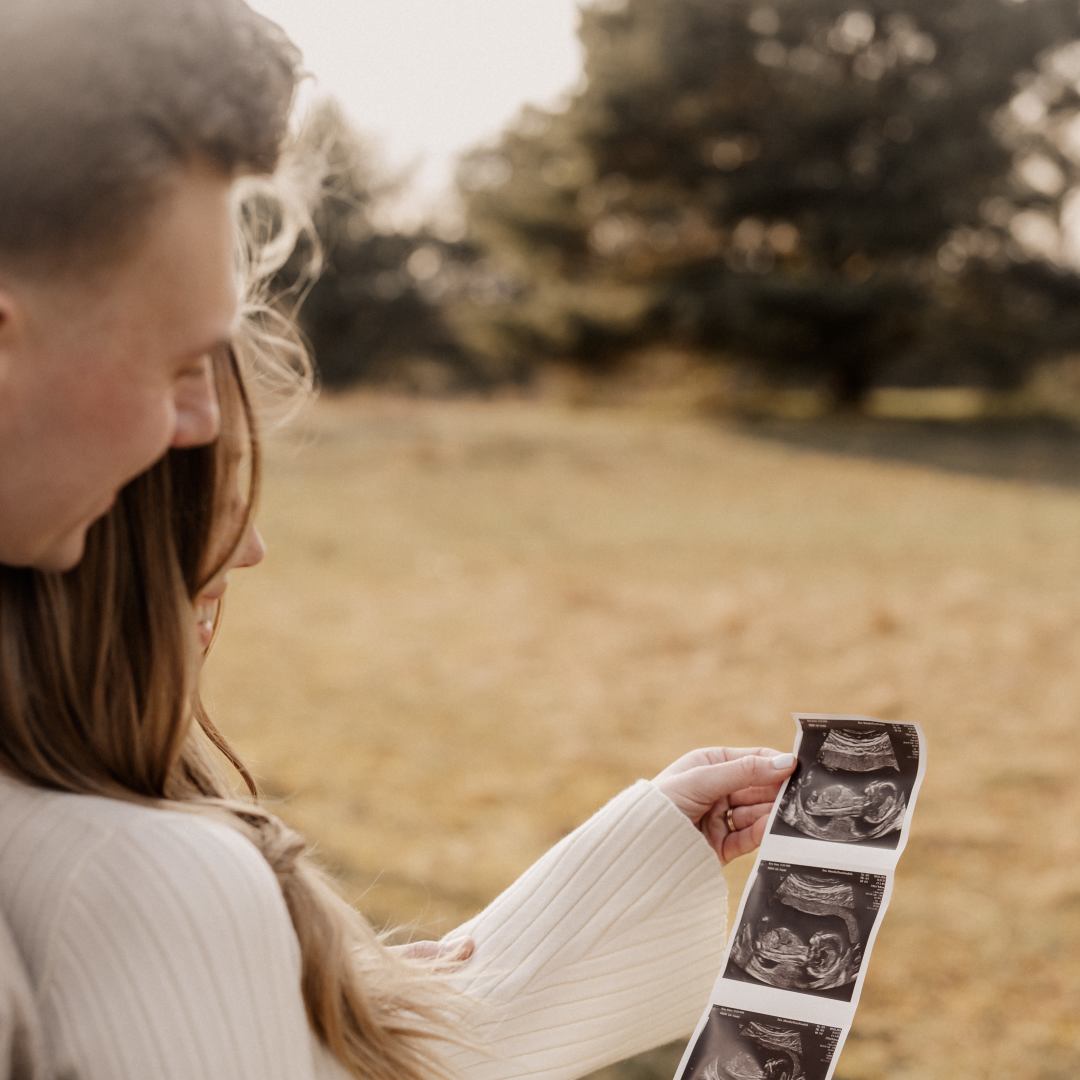 Photo shared by Anna for their Babylist baby registry.