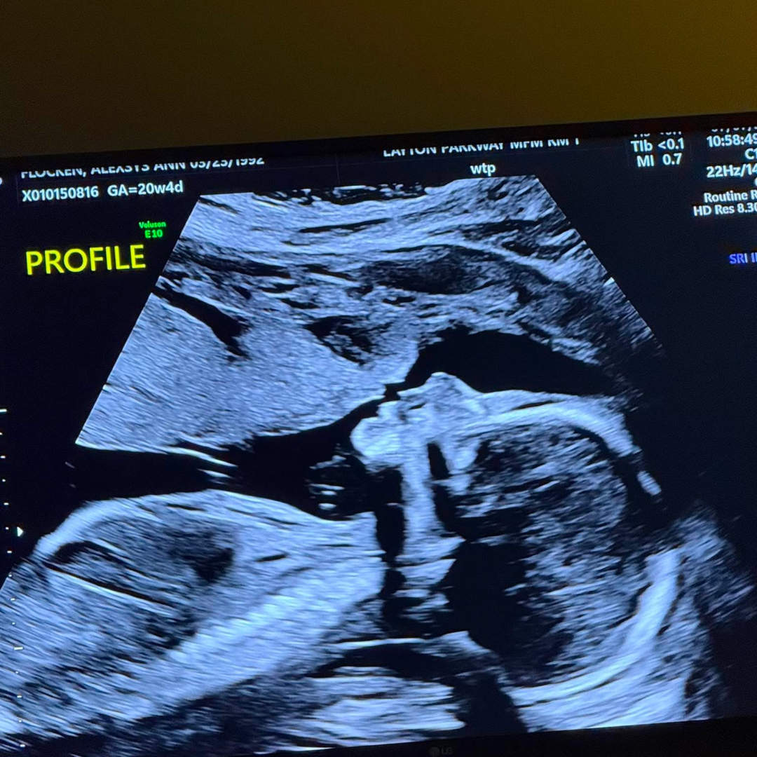 Photo shared by Alexsys for their Babylist baby registry.