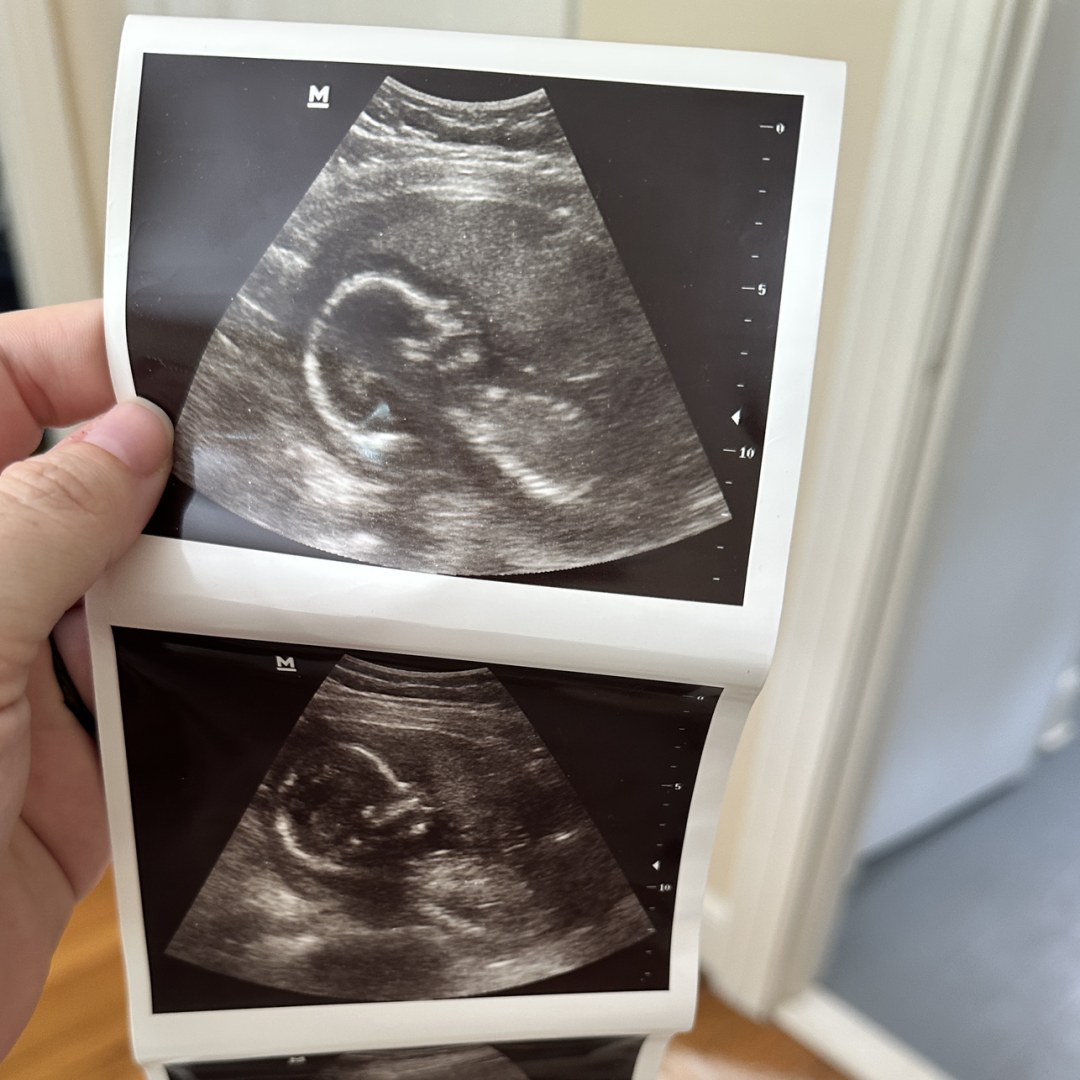 Photo shared by Carli for their Babylist baby registry.