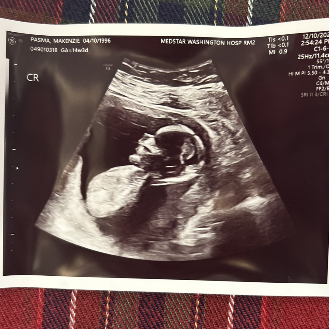 Photo shared by Makenzie for their Babylist baby registry.