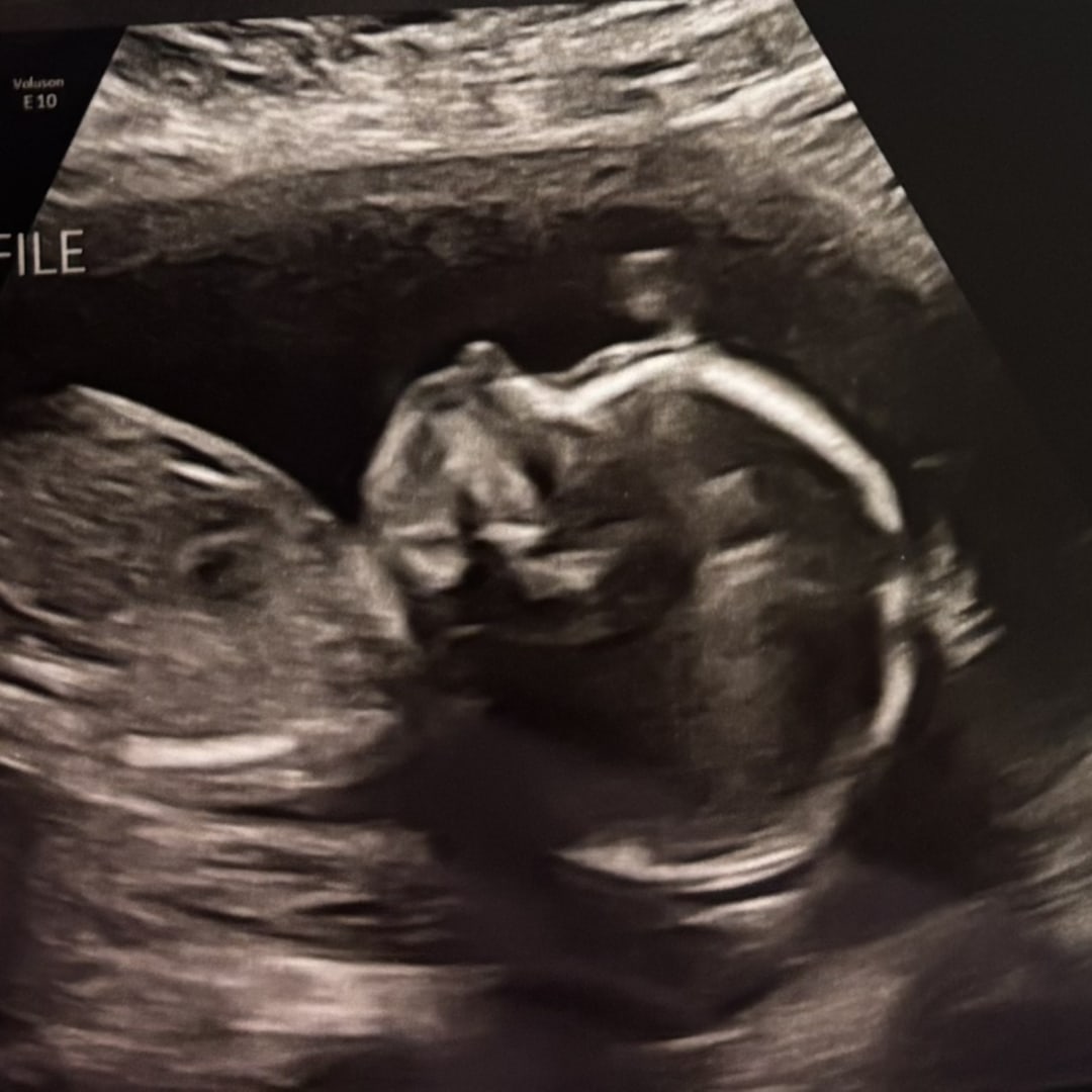 Photo shared by Savannah for their Babylist baby registry.