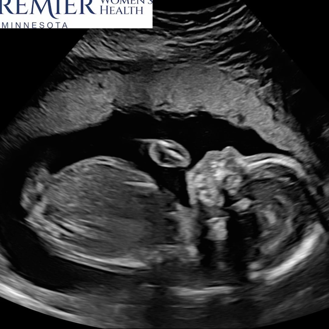 Photo shared by Kari for their Babylist baby registry.