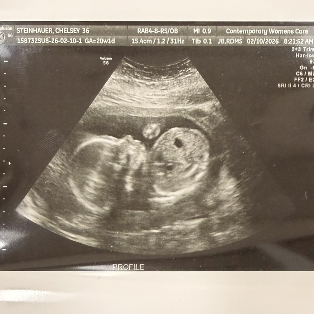 Photo shared by Chelsey for their Babylist baby registry.