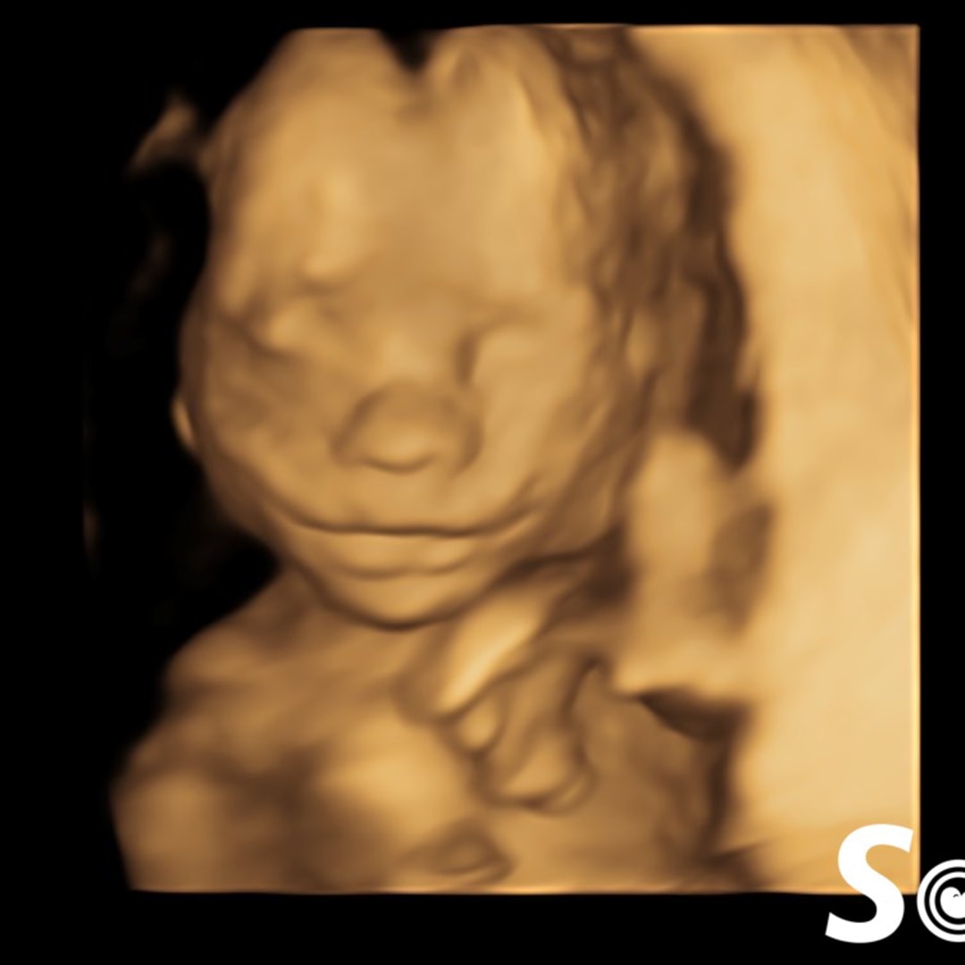 Photo shared by Beth for their Babylist baby registry.