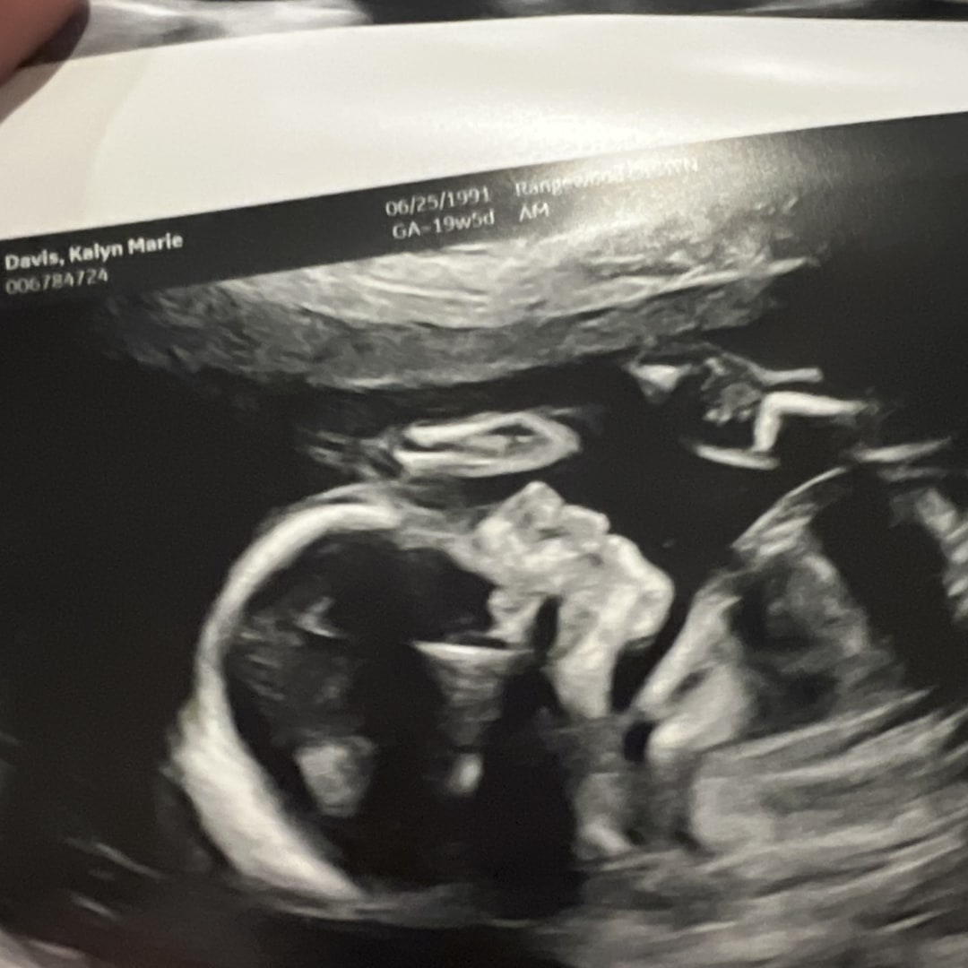 Photo shared by Kalyn for their Babylist baby registry.
