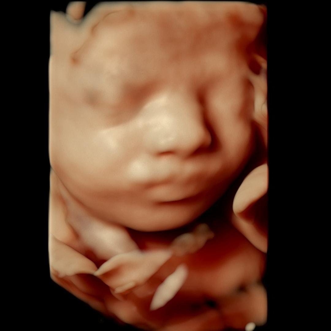 Photo shared by Ava for their Babylist baby registry.