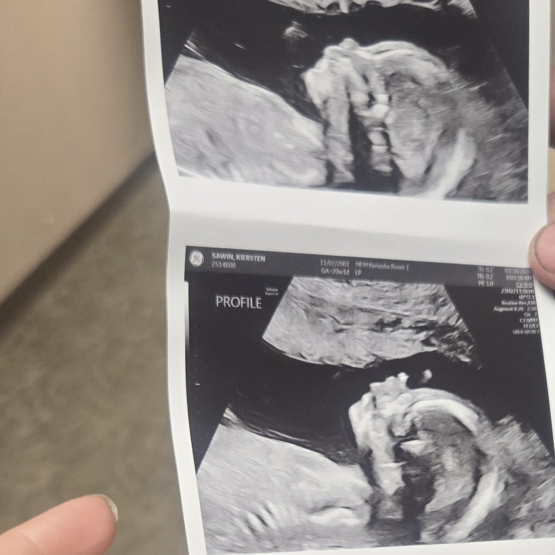 Photo shared by Kiersten for their Babylist baby registry.