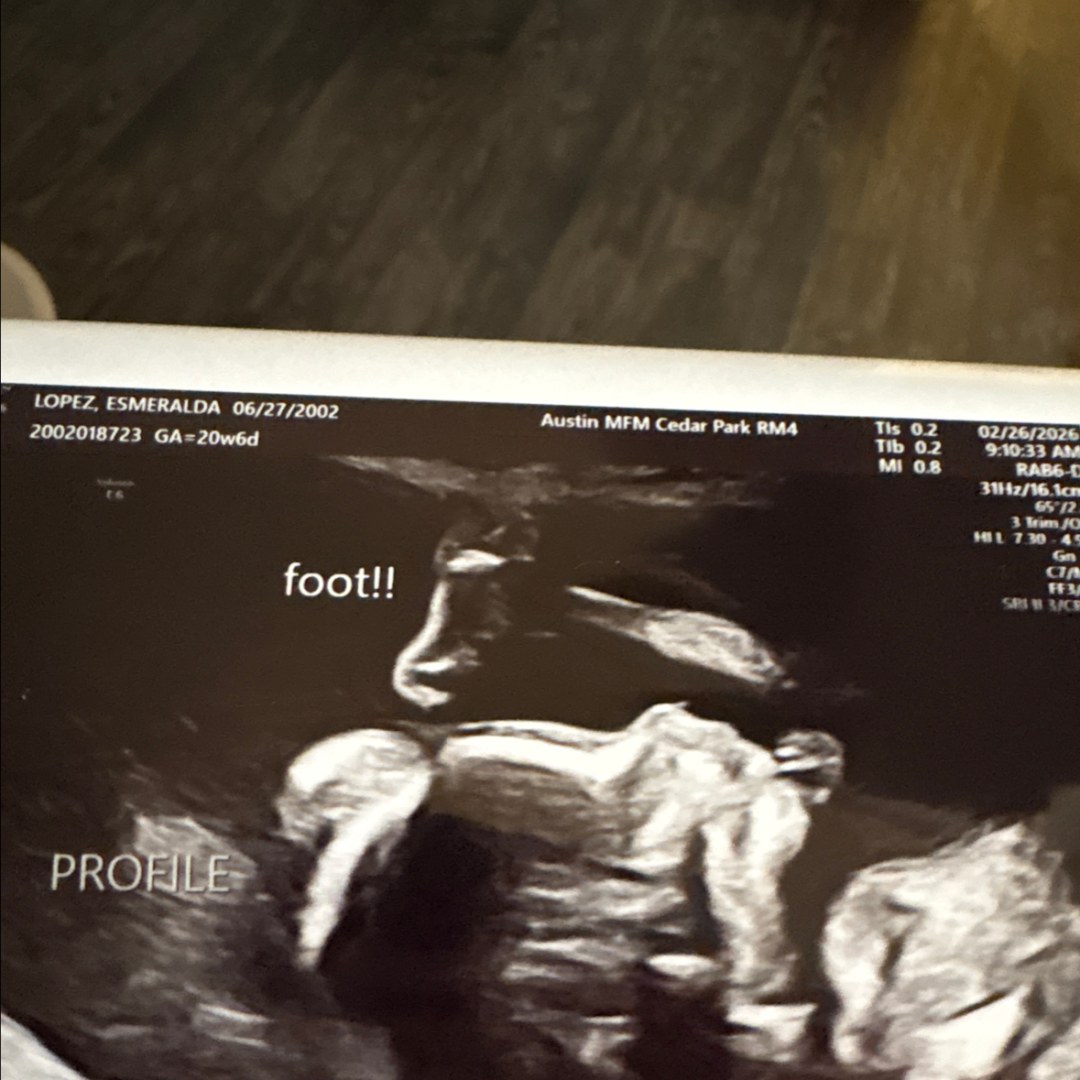 Photo shared by Josh for their Babylist baby registry.