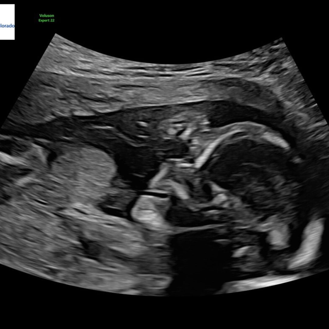 Photo shared by Abbie for their Babylist baby registry.