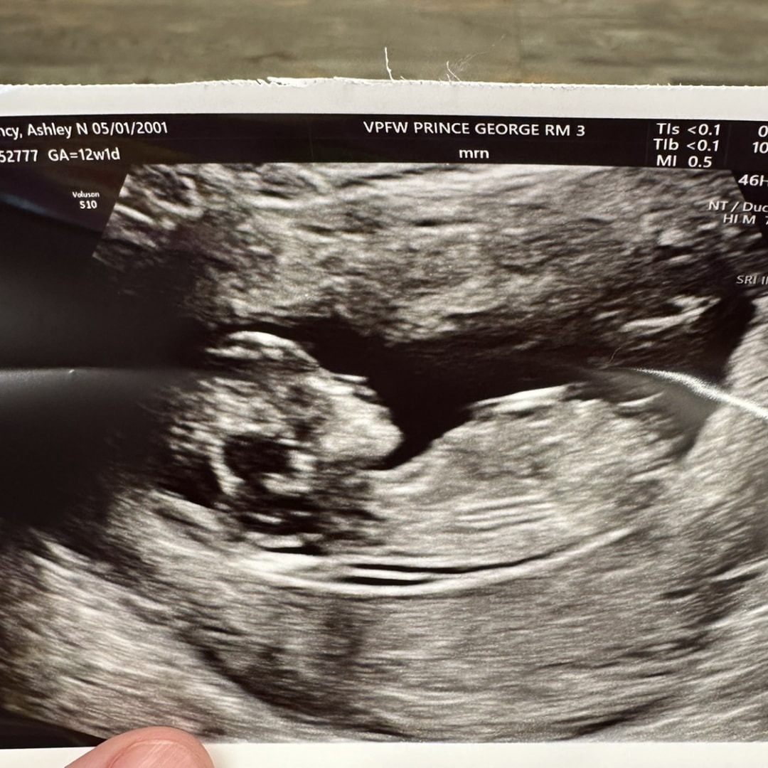 Photo shared by Ashley for their Babylist baby registry.