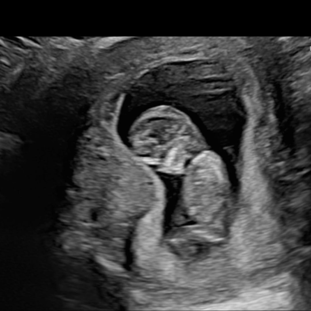 Photo shared by Jayda for their Babylist baby registry.