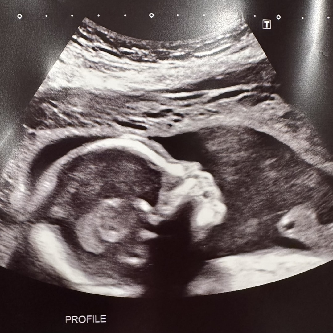 Photo shared by Gozde for their Babylist baby registry.