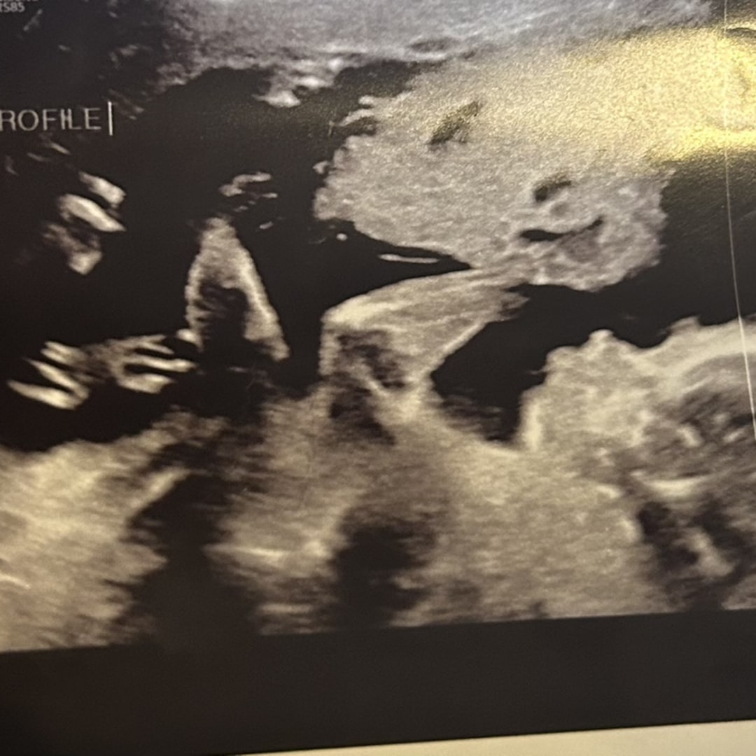 Photo shared by Jess for their Babylist baby registry.