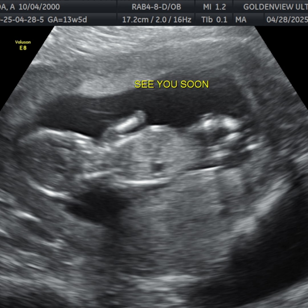 Photo shared by Alyssa for their Babylist baby registry.