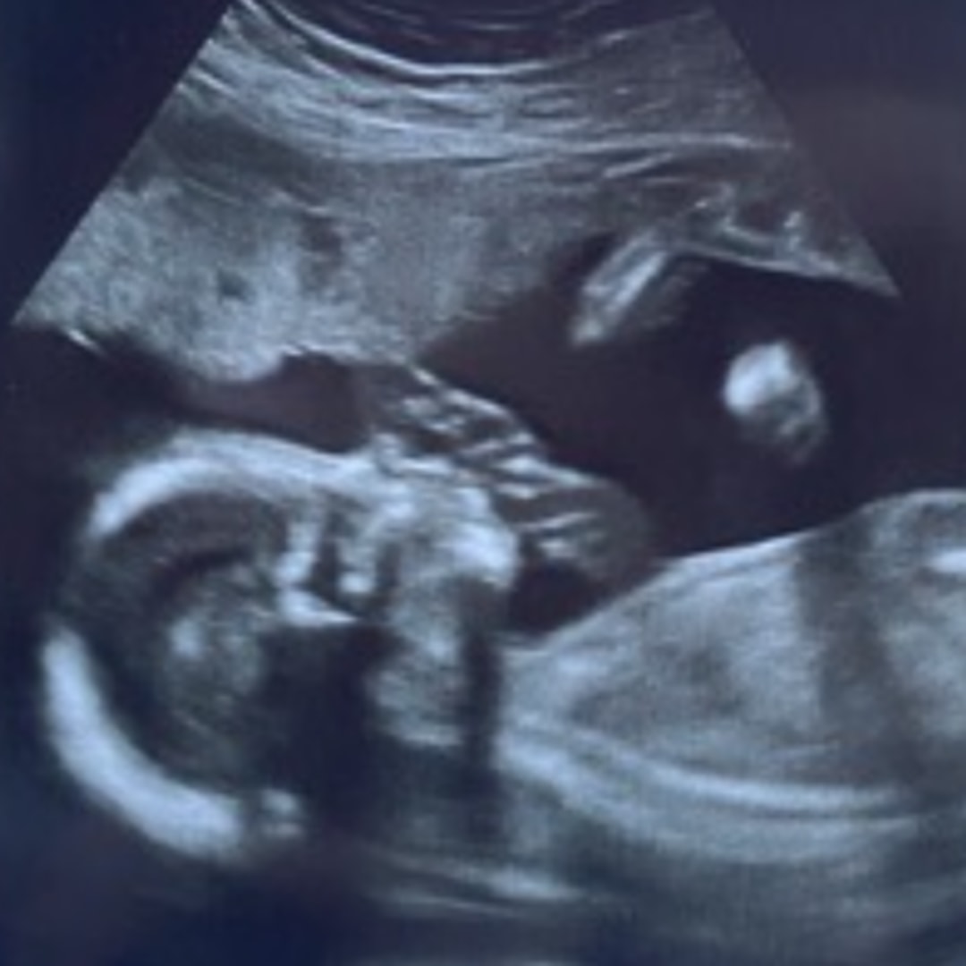 Photo shared by Laila for their Babylist baby registry.