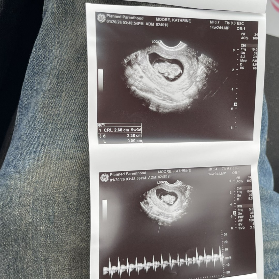 Photo shared by Katherine for their Babylist baby registry.