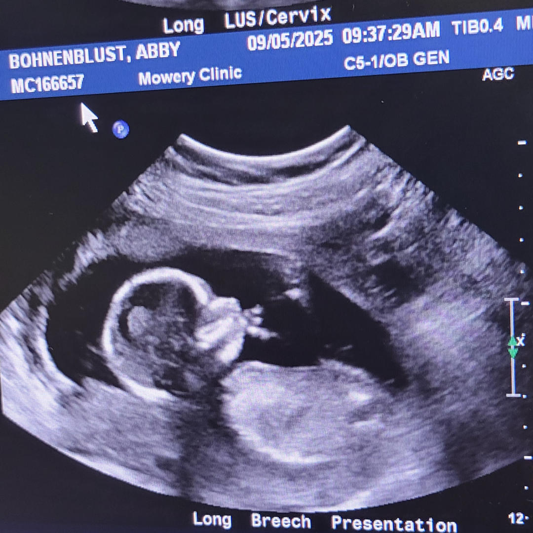 Photo shared by Abby for their Babylist baby registry.