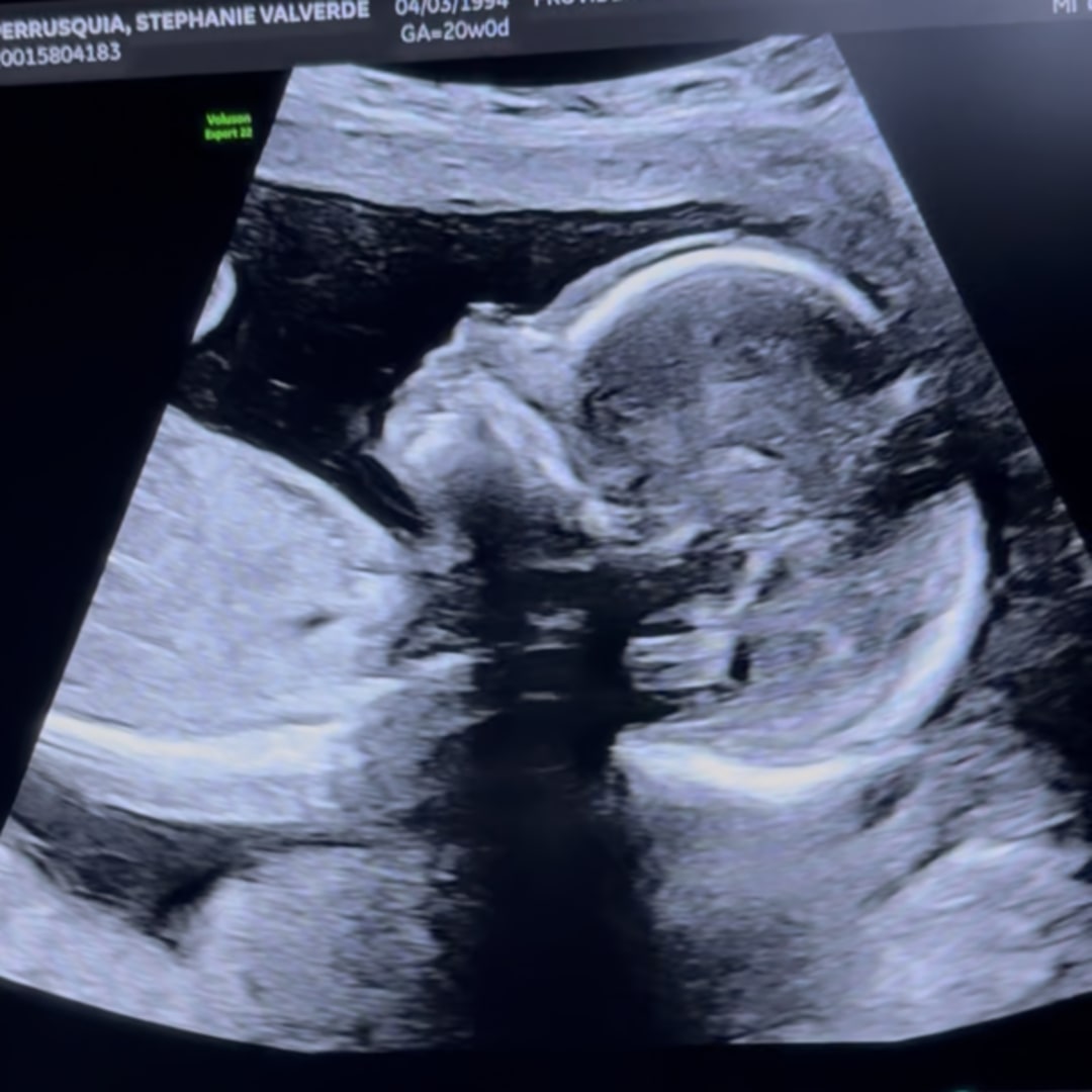 Photo shared by Stephanie for their Babylist baby registry.