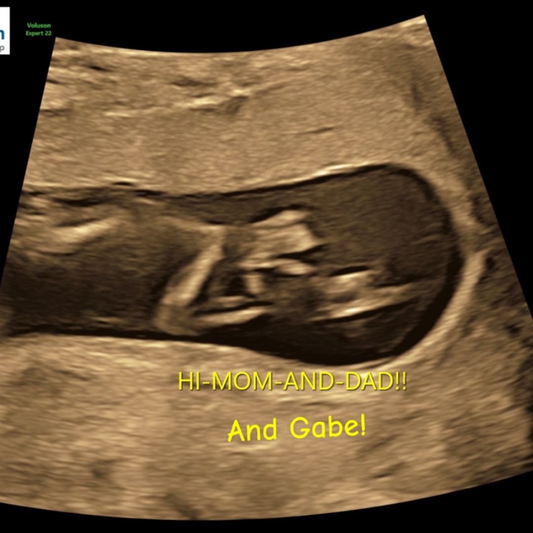 Photo shared by Ashley for their Babylist baby registry.