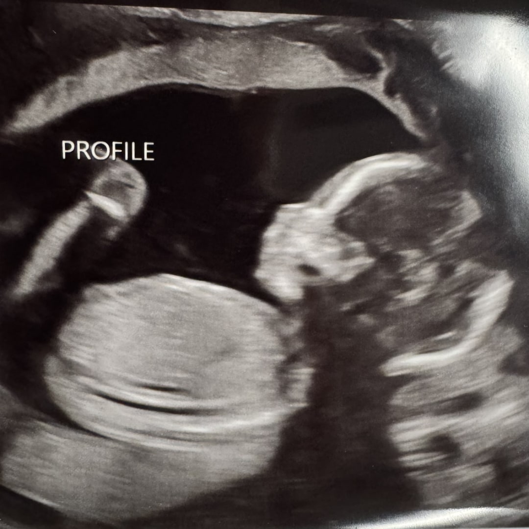 Photo shared by Anna for their Babylist baby registry.
