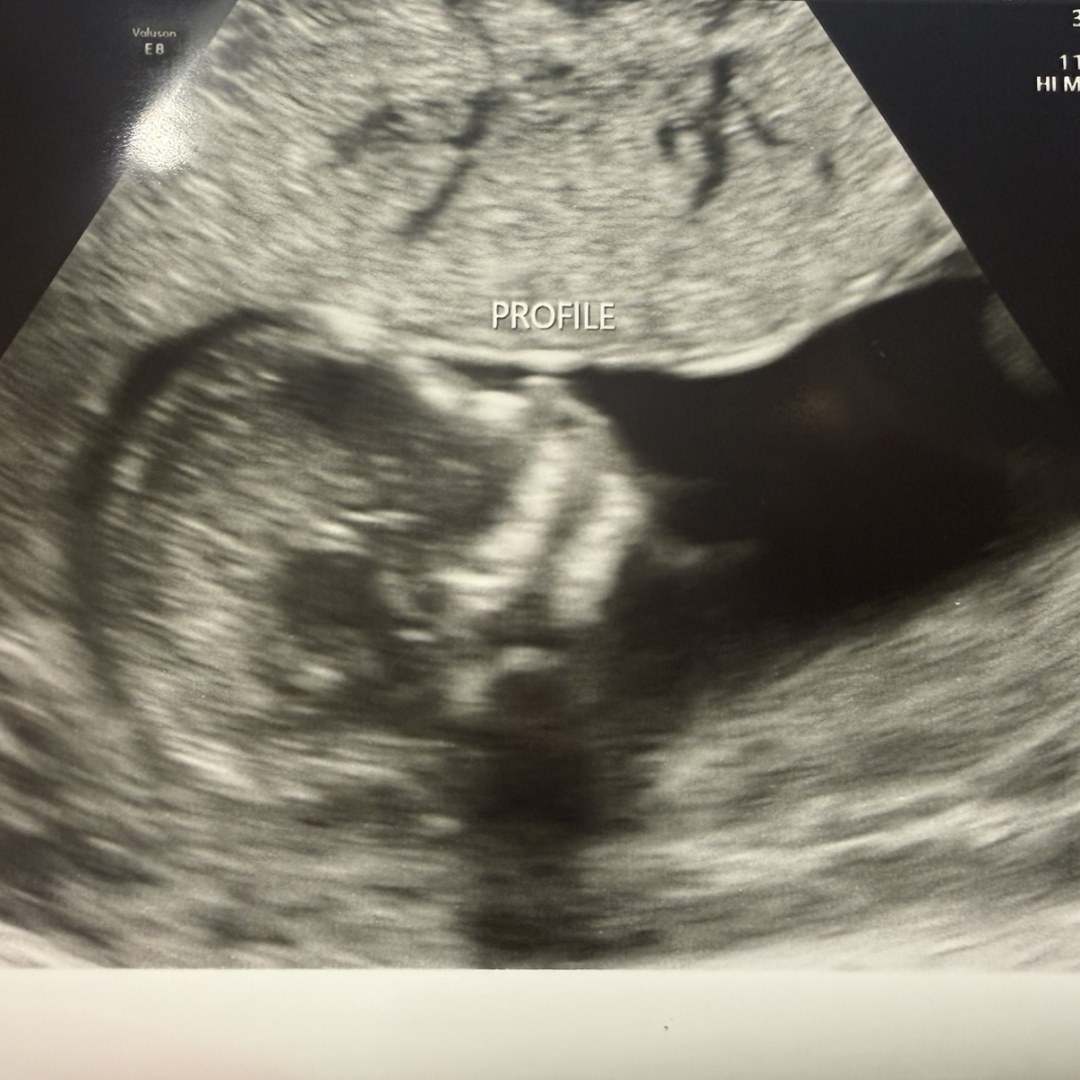Photo shared by Heather for their Babylist baby registry.