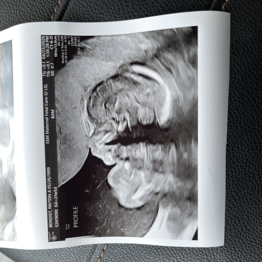 Photo shared by Payton for their Babylist baby registry.