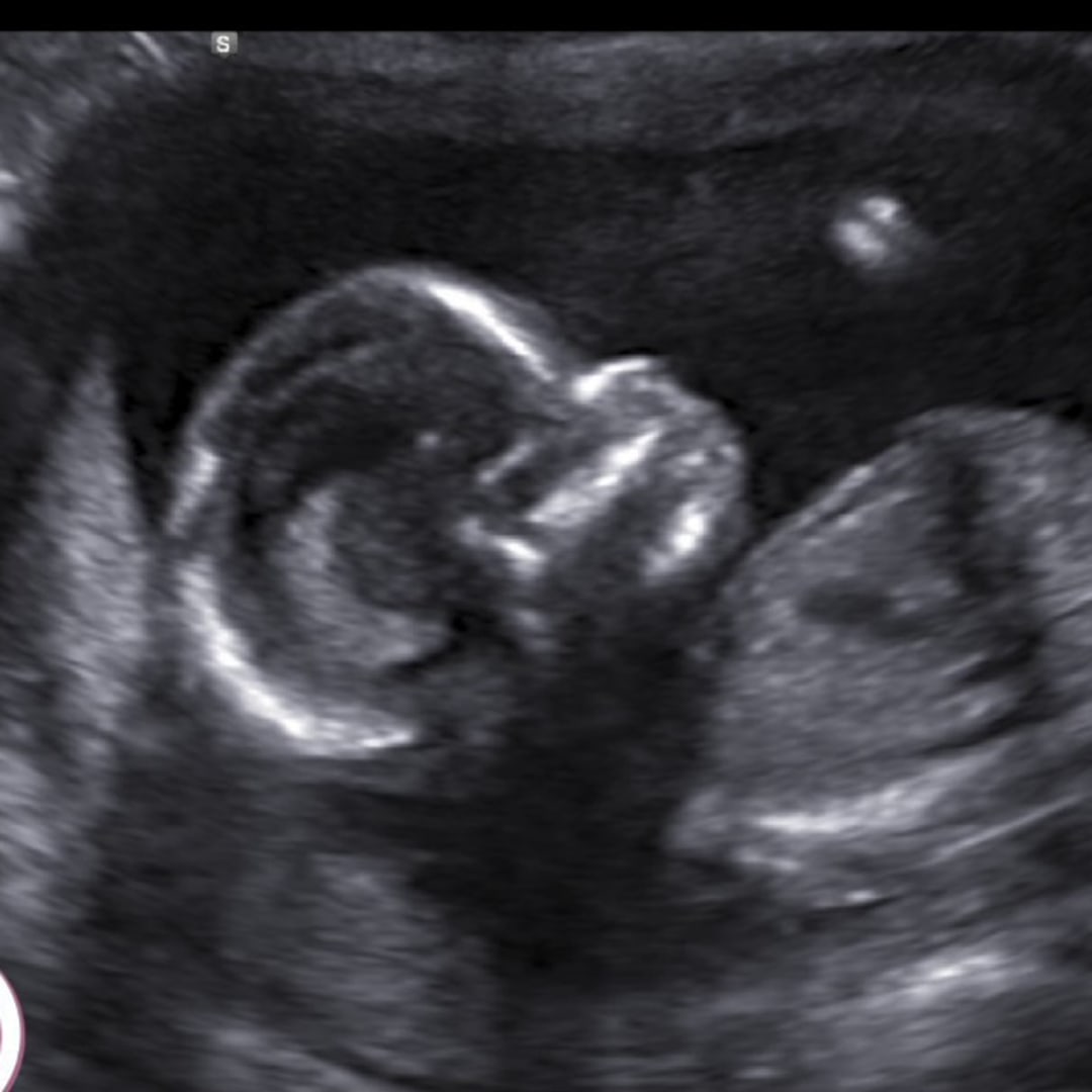 Photo shared by Chante for their Babylist baby registry.