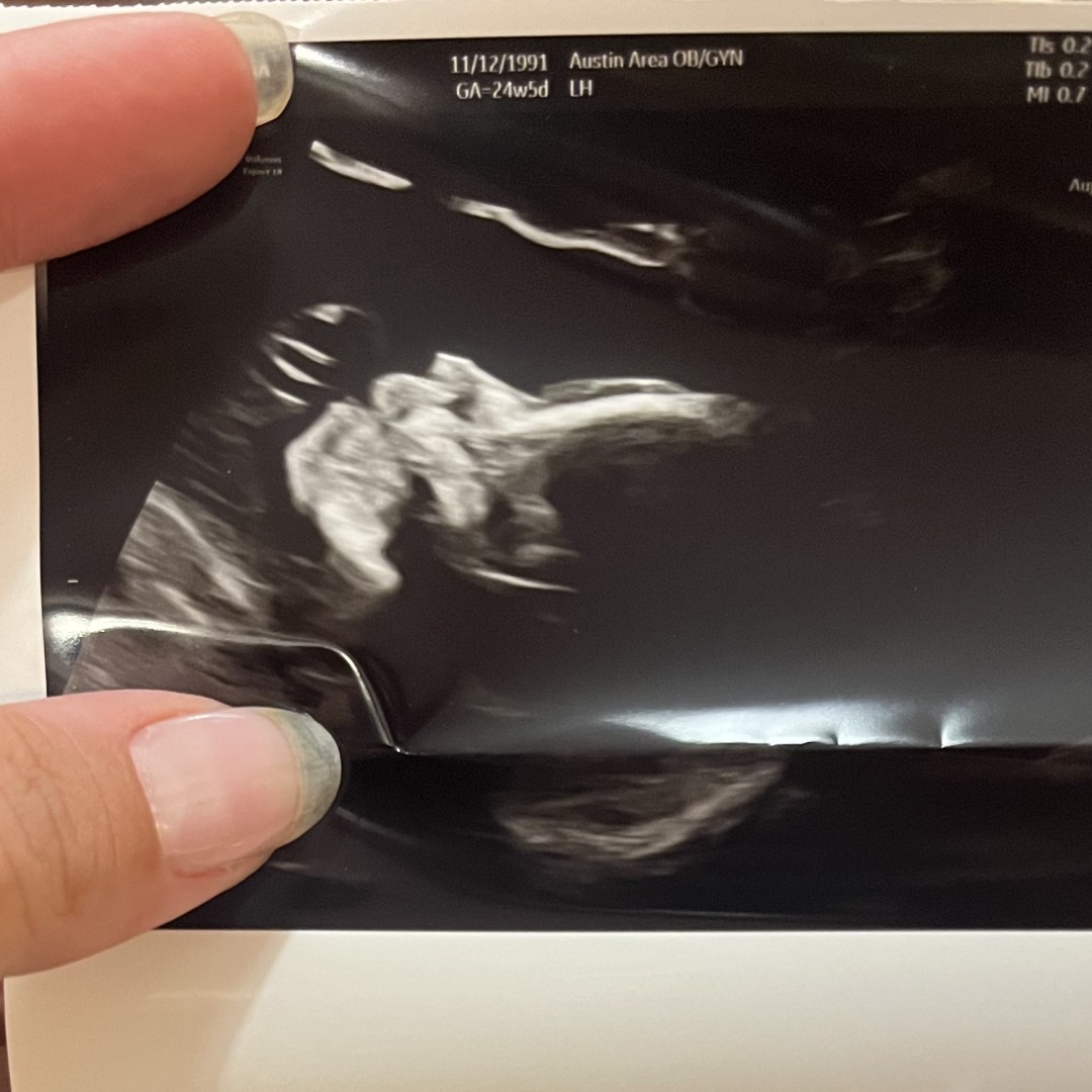 Photo shared by Celina for their Babylist baby registry.