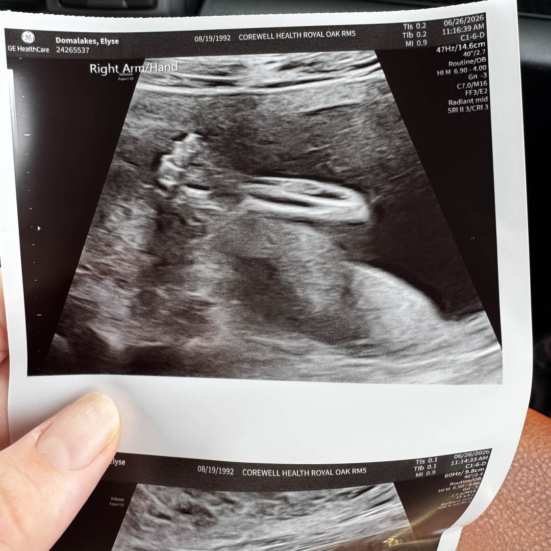 Photo shared by Elyse for their Babylist baby registry.