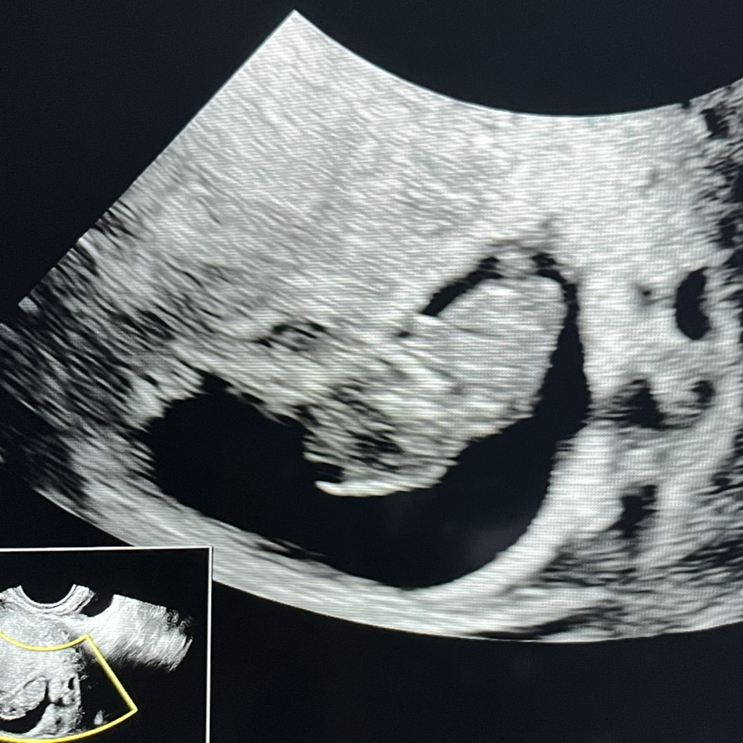 Photo shared by Rachael for their Babylist baby registry.