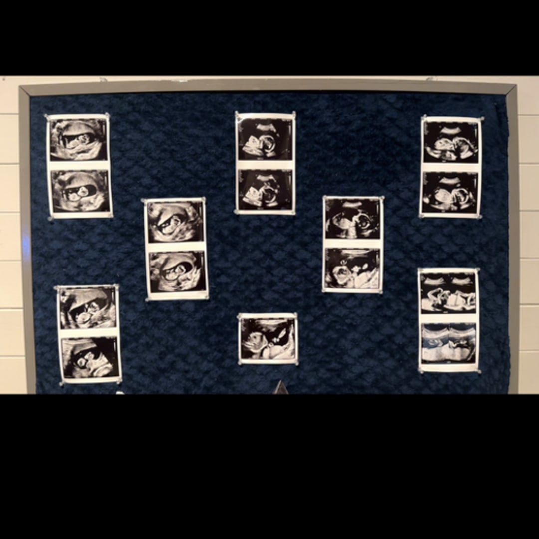 Photo shared by Hannah for their Babylist baby registry.