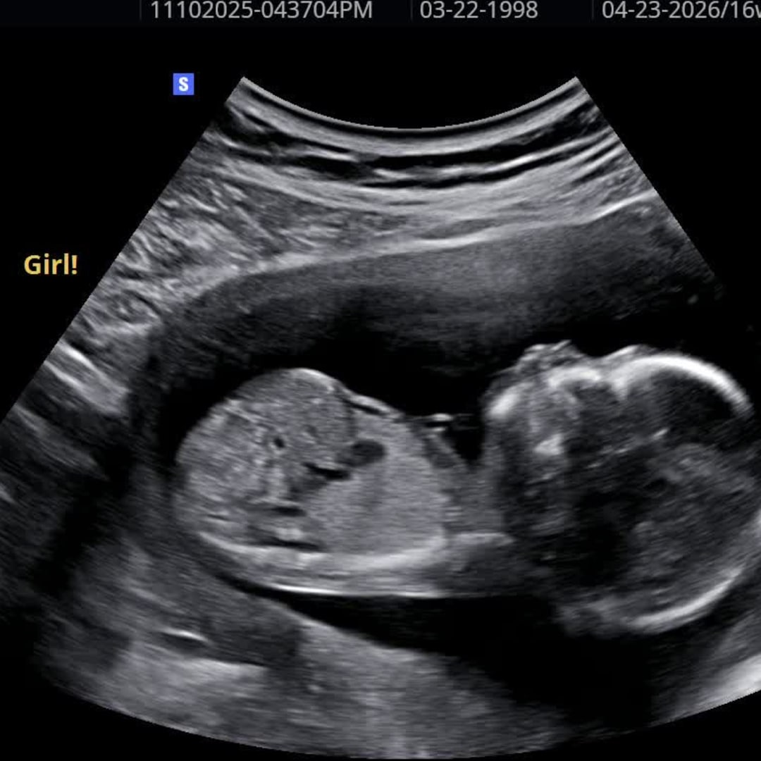 Photo shared by Katie for their Babylist baby registry.