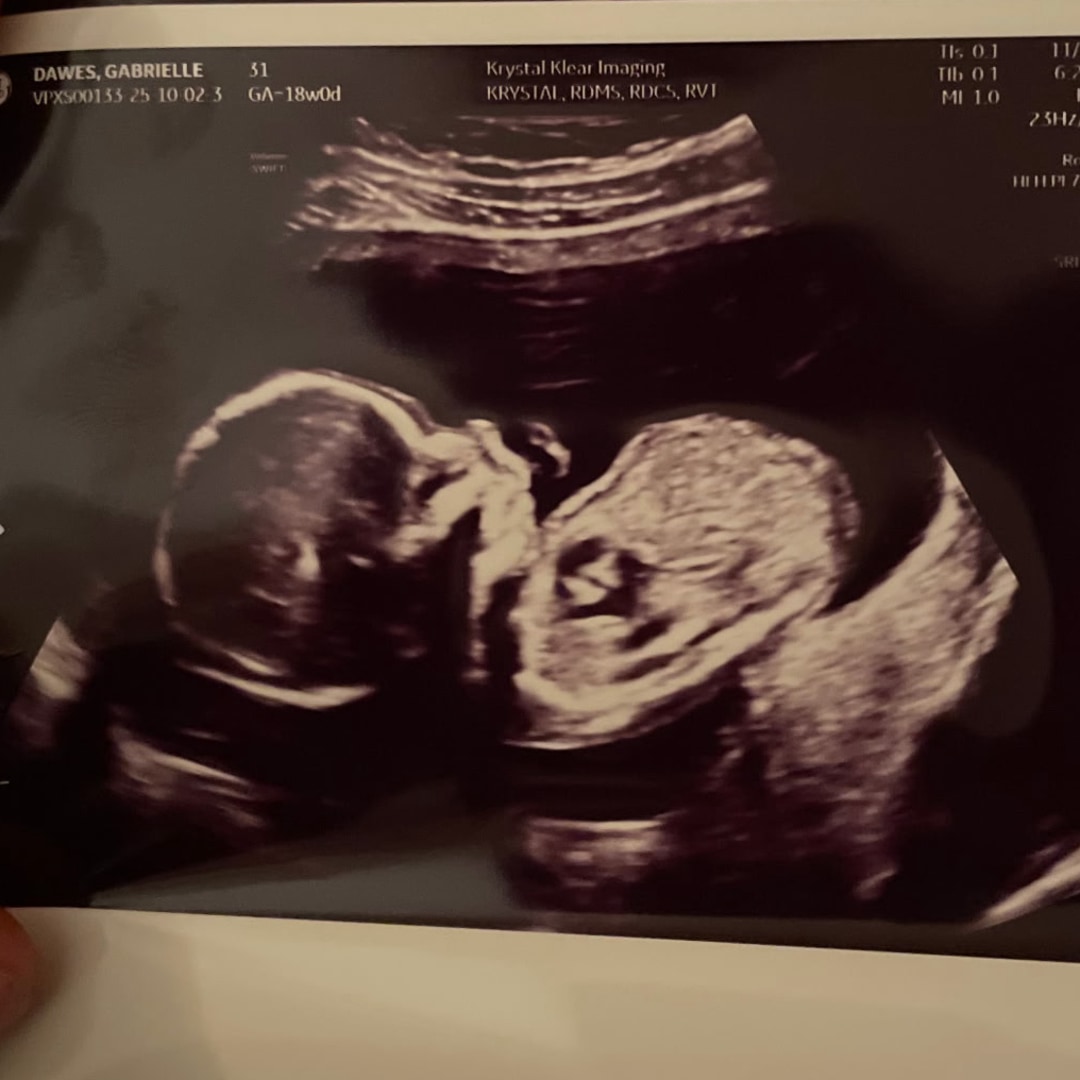 Photo shared by Allison for their Babylist baby registry.