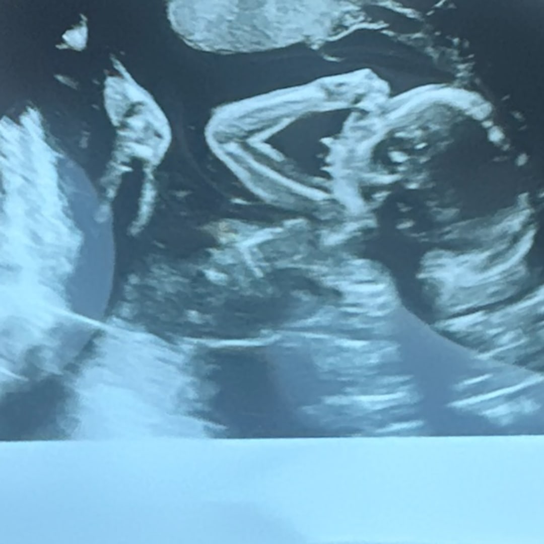 Photo shared by Emily for their Babylist baby registry.