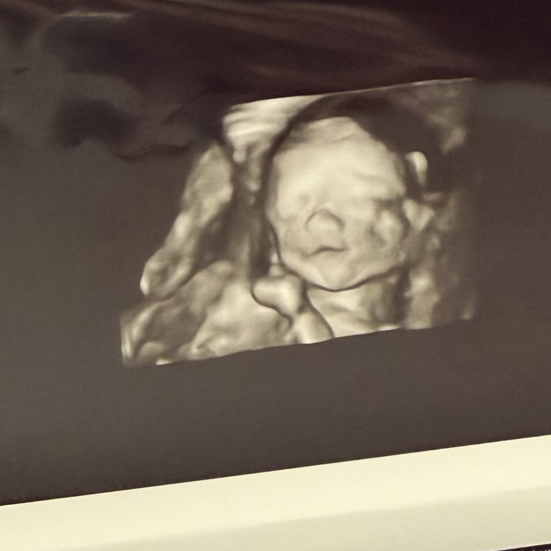 Photo shared by Andrea for their Babylist baby registry.